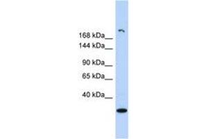 Image no. 1 for anti-Ubiquitously Transcribed Tetratricopeptide Repeat Gene, Y-Linked (UTY) (AA 971-1020) antibody (ABIN6742129) (UTY anticorps  (AA 971-1020))