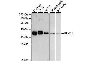 Western blot analysis of extracts of various cell lines, using RBM11 antibody (ABIN6133082, ABIN6146756, ABIN6146757 and ABIN6217133) at 1:3000 dilution. (RBM11 anticorps  (AA 1-281))