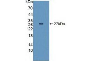 Western blot analysis of recombinant Human INSRR.