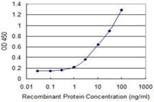 Detection limit for recombinant GST tagged LSM1 is 0.