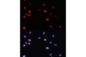 Immunofluorescence analysis of HeLa cells using DNMT3B Rabbit pAb (ABIN3016943, ABIN3016944, ABIN3016945 and ABIN6219896) at dilution of 100 (40x lens). (DNMT3B anticorps)