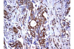 Image no. 3 for anti-Tumor Necrosis Factor Receptor Superfamily, Member 8 (TNFRSF8) (AA 19-379) antibody (ABIN1491084)