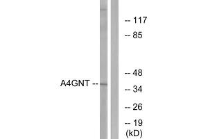 Western blot analysis of extracts from K562 cells, using A4GNT antibody. (A4GNT anticorps  (Internal Region))