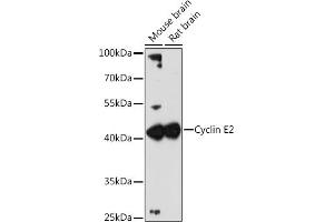 Western blot analysis of extracts of various cell lines, using Cyclin E2 antibody (ABIN1679046, ABIN3018761, ABIN3018762 and ABIN6220571) at 1:3000 dilution.