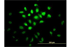 Immunofluorescence of monoclonal antibody to MSI1 on HeLa cell.
