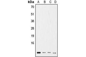 Western blot analysis of Ub expression in HeLa (A), NIH3T3 (B), rat kidney (C), HL60 (D) whole cell lysates.