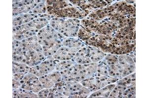 Immunohistochemical staining of paraffin-embedded liver tissue using anti-ERCC1 mouse monoclonal antibody. (ERCC1 anticorps)