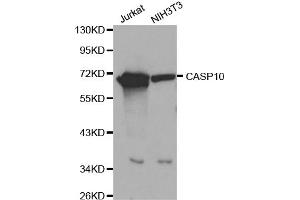 Western blot analysis of extracts of various cell lines, using CASP10 antibody (ABIN5970048) at 1/1000 dilution. (Caspase 10 anticorps)