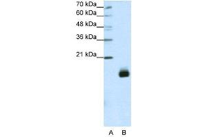 WB Suggested Anti-RPS14  Antibody Titration: 1. (RPS14 anticorps  (N-Term))