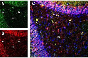 anti-Protein Interacting With Protein Kinase C, alpha 1 (PICK1) (AA 305-318), (Intracellular) antibody
