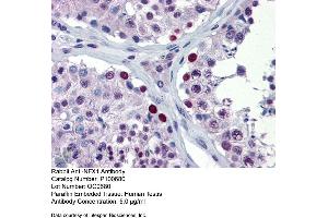 Immunohistochemistry with Human Testis lysate tissue (NFX1 anticorps  (Middle Region))