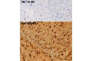 Immunohistochemistry (IHC) image for anti-Protein Disulfide Isomerase Family A, Member 3 (PDIA3) (C-Term) antibody (ABIN1440039)