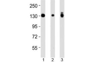 Western blot testing of Integrin alpha 3 antibody at 1:4000 dilution and 1) A431 lysate, 2) HeLa lysate, and 3) PC3 lysate at 1:2000.