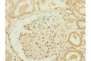 Immunohistochemistry of paraffin-embedded human kidney tissue using ABIN7170096 at dilution of 1:100 (SLC13A2 anticorps  (AA 345-455))