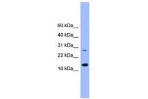 Image no. 1 for anti-Glutaredoxin 2 (GRX2) (AA 91-141) antibody (ABIN6745473) (Glutaredoxin 2 anticorps  (AA 91-141))