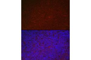 Immunofluorescence analysis of mouse spleen using LILRB4 Rabbit pAb (ABIN6131872, ABIN6143221, ABIN6143222 and ABIN6222869) at dilution of 1:100 (40x lens).