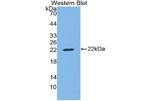 Western blot analysis of the recombinant protein. (CD8B anticorps  (AA 22-175))