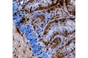 IHC analysis of HIF-1 alpha/HIF1A using anti-HIF-1 alpha/HIF1A antibody (ABIN7602159).