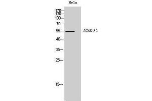 Western Blotting (WB) image for anti-AChR beta 1 (N-Term) antibody (ABIN3173651) (AChR beta 1 (N-Term) anticorps)