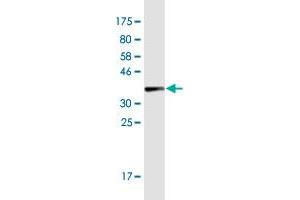 Western Blot detection against Immunogen (37.