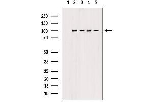 Western blot analysis of extracts from various samples, using PSMD2 Antibody.