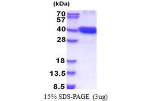 SDS-PAGE (SDS) image for Cyclin-Dependent Kinase 16 (CDK16) (AA 158-496) protein (His tag) (ABIN5853364) (CDK16 Protein (AA 158-496) (His tag))
