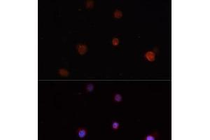 Immunofluorescence analysis of THP-1 cells using NLRC4 Polyclonal Antibody (NLRC4 anticorps)