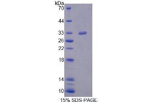 SDS-PAGE analysis of Mouse STK11 Protein. (LKB1 Protéine)