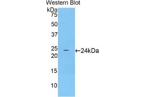Western blot analysis of the recombinant protein. (TNNI1 anticorps  (AA 1-187))
