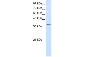 WB Suggested Anti-LMX1A Antibody Titration:  0. (LMX1A anticorps  (Middle Region))