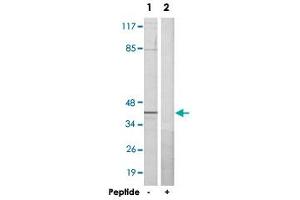 Western blot analysis of extracts from HeLa cells, using RBMX polyclonal antibody . (RBMX anticorps  (N-Term))