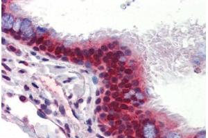 Human Lung, Respiratory Epithelium (formalin-fixed, paraffin-embedded) stained with UBQLN1 antibody ABIN462260 followed by biotinylated goat anti-rabbit IgG secondary antibody ABIN481713, alkaline phosphatase-streptavidin and chromogen.