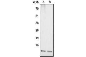 Western blot analysis of COX17 expression in IMR32 (A), HepG2 (B) whole cell lysates. (COX17 anticorps  (N-Term))