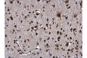 IHC-P Image ZNF346 antibody [N1C3] detects ZNF346 protein at cytoplasm and nucleus in rat brain by immunohistochemical analysis. (ZNF346 anticorps)