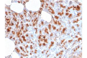 Formalin-fixed, paraffin-embedded human Pancreas stained with MDM2 Mouse Monoclonal Antibody (MDM2/2414). (MDM2 anticorps  (AA 126-254))