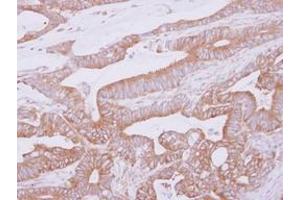 Image no. 1 for anti-THUMP Domain Containing 2 (THUMPD2) (AA 246-491) antibody (ABIN1501385) (THUMPD2 anticorps  (AA 246-491))