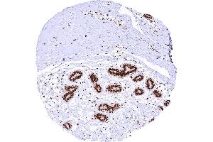 Breast gland with strong nuclear MRE11 staining of all cells.