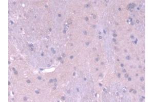 Detection of MTF1 in Mouse Cerebrum Tissue using Polyclonal Antibody to Metal Regulatory Transcription Factor 1 (MTF1)