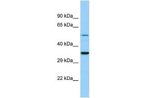 Western Blotting (WB) image for anti-Membrane Bound O-Acyltransferase Domain Containing 4 (MBOAT4) (C-Term) antibody (ABIN2444668) (MBOAT4 anticorps  (C-Term))