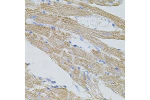 Immunohistochemistry of paraffin-embedded mouse heart using TRP antibody (ABIN6133559, ABIN6149565, ABIN6149567 and ABIN6224668) at dilution of 1:100 (40x lens). (TRPA1 anticorps  (AA 850-950))