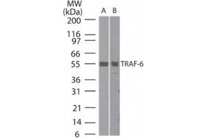 Western Blotting (WB) image for anti-TNF Receptor-Associated Factor 6 (TRAF6) (AA 436-449) antibody (ABIN208879) (TRAF6 anticorps  (AA 436-449))