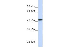 WB Suggested Anti-CLN8 Antibody Titration:  0. (CLN8 anticorps  (N-Term))