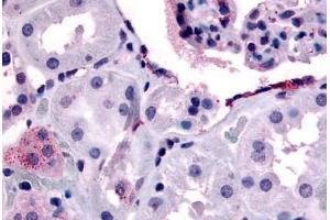 Human Glomerulus and Renal Tubular Epithelium in Cortex (formalin-fixed, paraffin-embedded) stained with ERBB4 antibody ABIN213400 at 15-32 ug/ml followed by biotinylated goat anti-rabbit IgG secondary antibody ABIN481713, alkaline phosphatase-streptavidin  .
