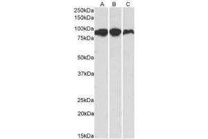 AP21267PU-N ACO2 Antibody staining of Human (A), Mouse (B) and Rat (C) Adipose lysates at 0. (ACO2 anticorps  (Internal Region))