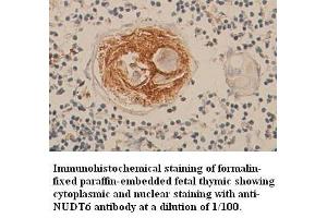 Image no. 1 for anti-Nudix (Nucleoside Diphosphate Linked Moiety X)-Type Motif 6 (NUDT6) (C-Term) antibody (ABIN791098)