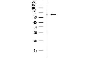 Western blot analysis of lysates from Hela cells(UV, 30 min treatment), using FOXJ2 Antibody at 1/1000 dilution.