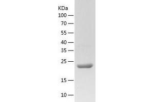Western Blotting (WB) image for Adenylate Kinase 1 (AK1) (AA 1-210) protein (His tag) (ABIN7121717) (Adenylate Kinase 1 Protein (AK1) (AA 1-210) (His tag))