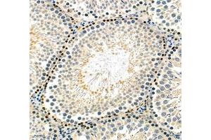 Immunohistochemistry of paraffin embedded rat testis using hmgn1 (ABIN7074222) at dilution of 1: 1800 (250x lens)