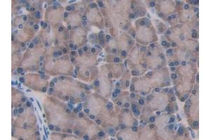 DAB staining on IHC-P; Samples: Rat Pancreas Tissue (GBA anticorps  (AA 248-508))