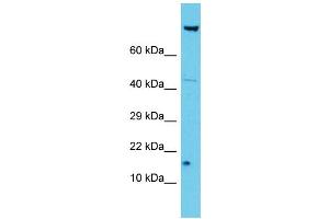 Host: Rabbit Target Name: NDUFA12 Sample Type: Jurkat Whole Cell lysates Antibody Dilution: 1. (NDUFA12 anticorps  (N-Term))